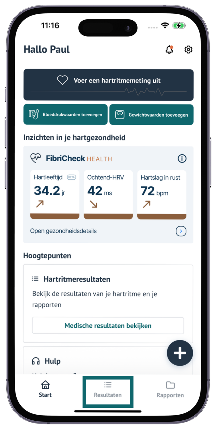 Het startscherm van de FibriCheck-app, met het tabblad Resultaten gemarkeerd in het menu onderaan.
