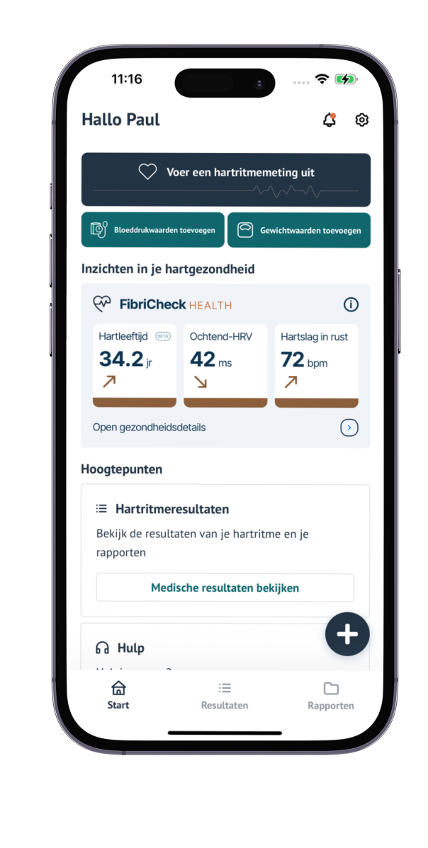 Het startscherm van de FibriCheck-app, met knoppen om een hartritmemeting uit te voeren, bloeddrukwaarden toe te voegen en gewichtswaarden toe te voegen.