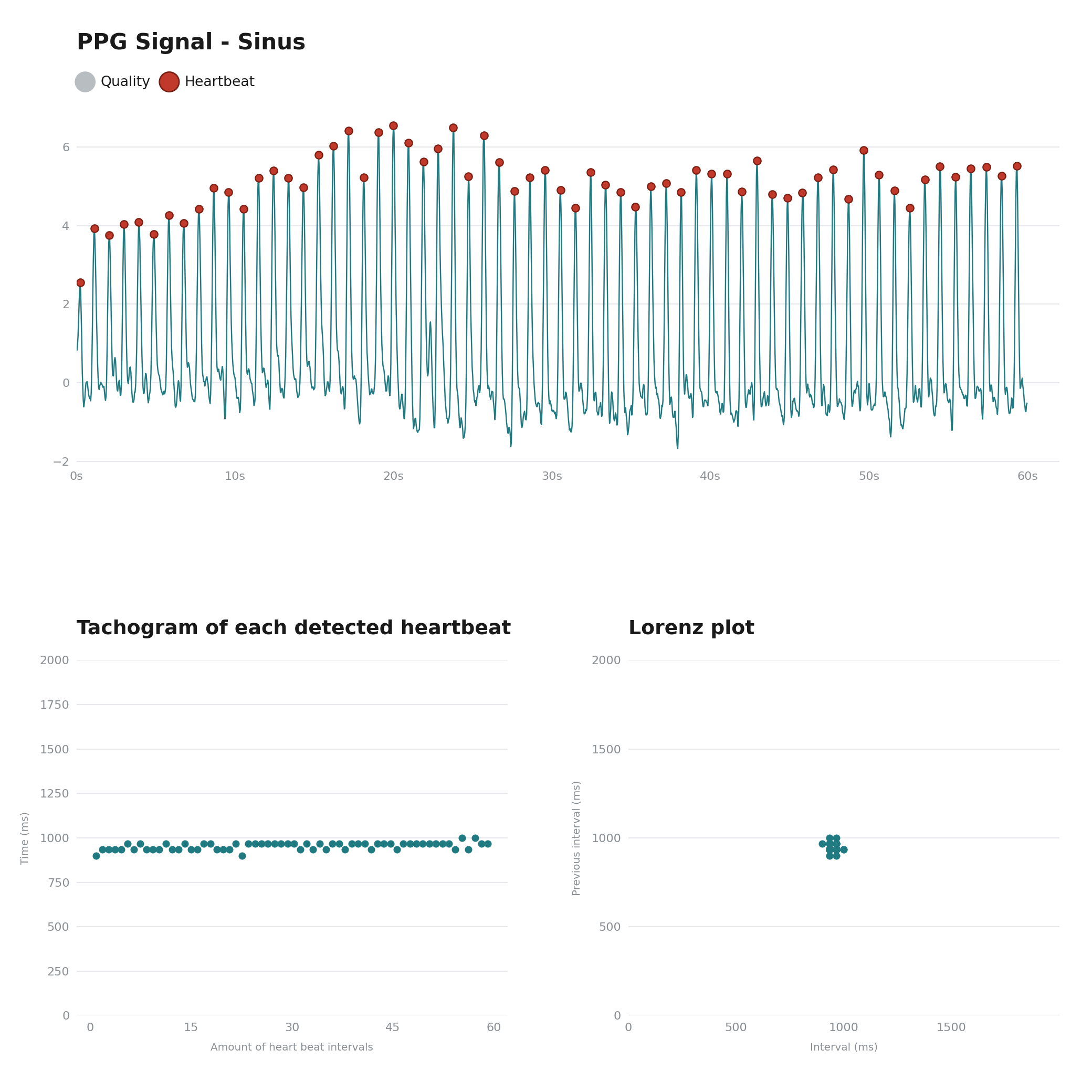 PPG analysis of a regular sinus rhythm